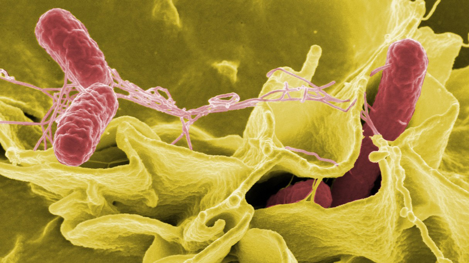 This is salmonella this is salmonella (NIH Image Gallery / Flickr)